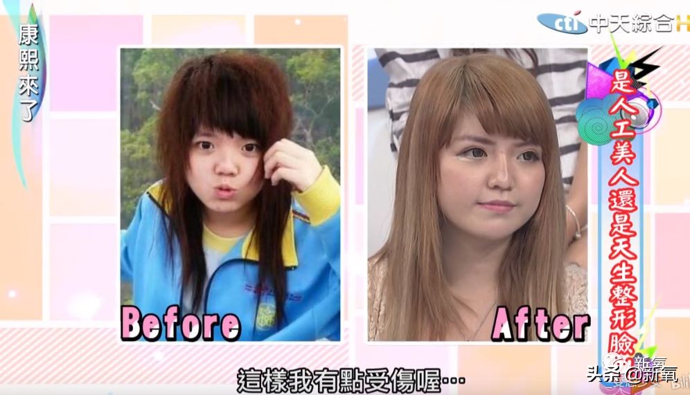 花90万从头整到脚,还可以这么自然?旁边纯天然小姐姐都看懵了