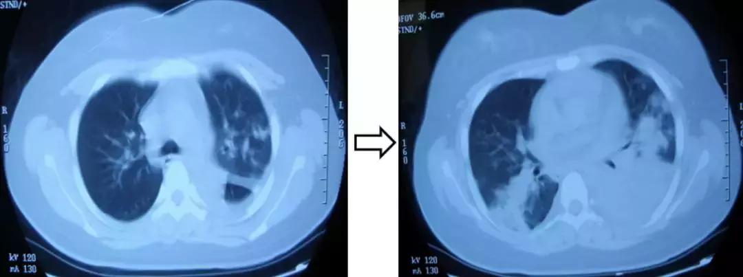 感染性疾病主要检测流程,感染性疾病筛查怎么做