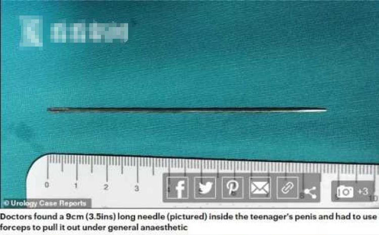 14岁男生把9厘米缝衣针插入尿道,痛苦三天去就医,网友:爽吗?