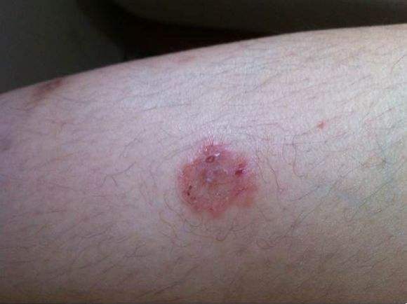 养猫警告人猫共同传染病你了解吗,新手养猫要注意预防什么疾病