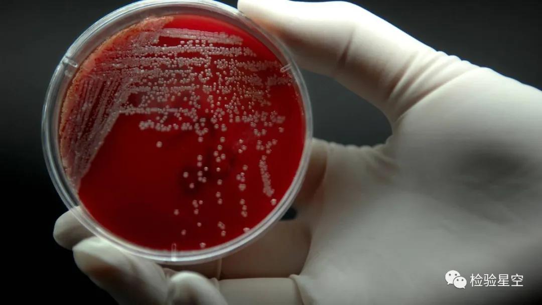 临床检验标本正确采集规范及注意事项