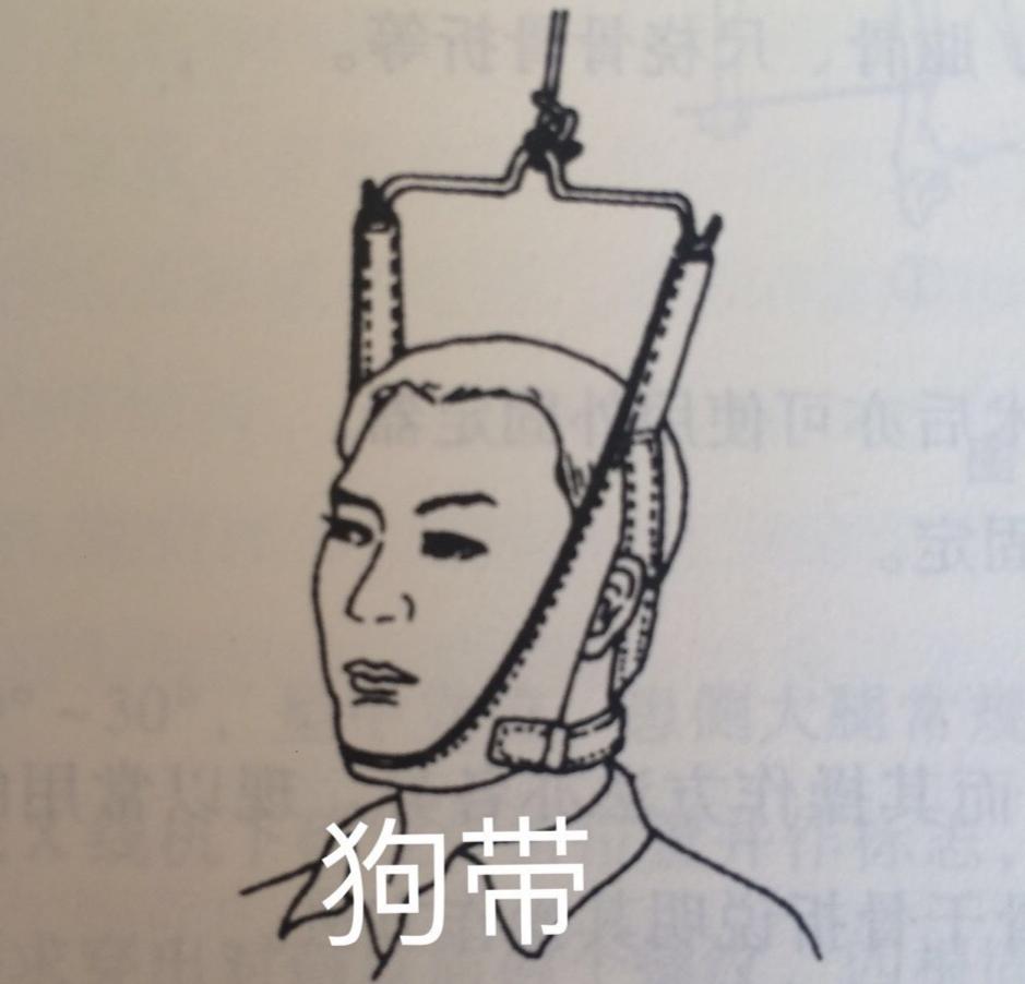 明星正骨后遗症,明星正骨效果明显