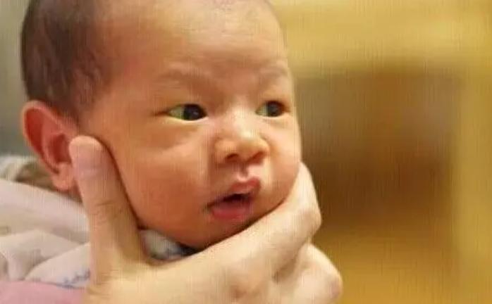 母乳性黄疸妈妈饮食禁忌,宝宝患母乳性黄疸怎么办