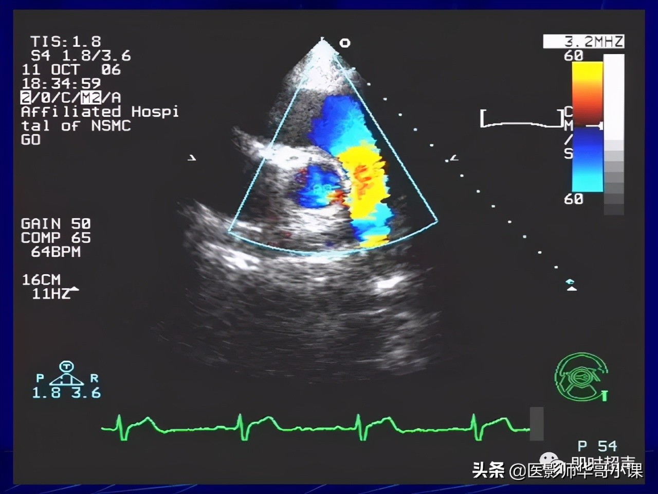 超声检查报告单讲解,超声图像检查