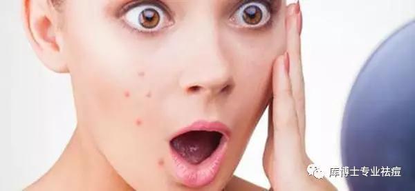 痘痘熟了怎么才能消除,痘痘戳不破怎么办