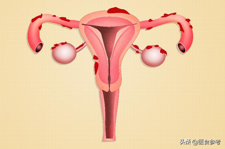 身体出现什么症状要警惕妇科疾病,妇科肿瘤的症状10大前兆