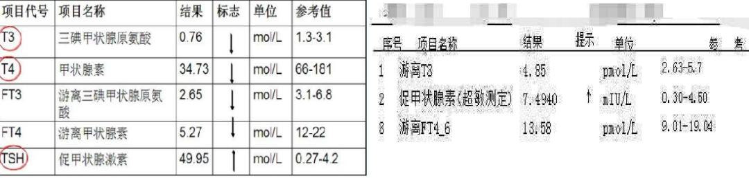 甲状腺结节悄悄偷走健康,岁月神偷被偷走的是什么
