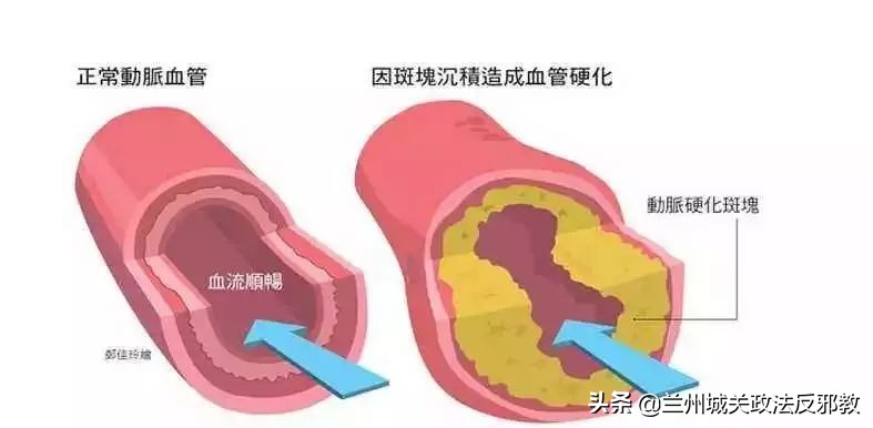 睡觉时总是手麻怎么回事中医,晚上睡觉手麻是怎么回事如何治愈