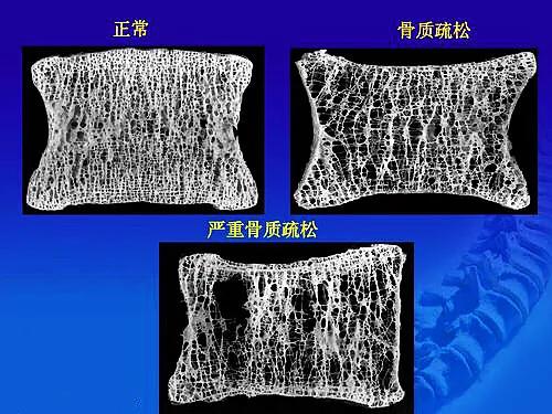 成人骨骼数量是多少,骨骼识别智能分析