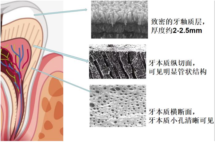 补牙后敏感遇冷热疼痛,补牙后牙齿敏感怎么处理最好