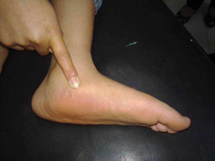 孩子学步最佳年龄,孩子x型腿怎么训练矫正