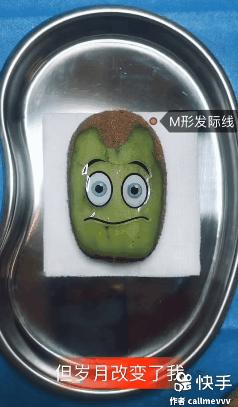 香蕉割包皮,洋葱剖腹产?这是我见过最秀的医生