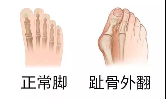 脚长怎么选鞋显脚小,脚胖脚宽不好看穿什么鞋