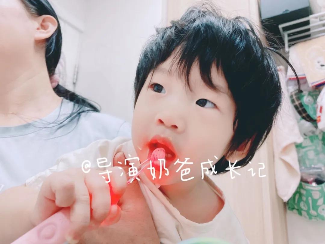 还在给小孩用儿童牙膏吗,牙医涂氟是拿什么涂氟