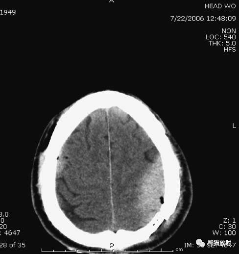 值夜班需要注意什么身体健康,值夜班的十大危害