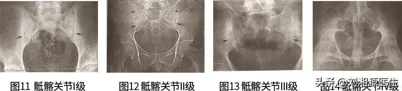 免疫相关不良妊娠诊断指南,免疫治疗不良妊娠的方法