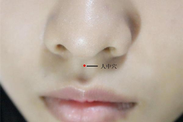 昏迷时应该掐人中急救,昏迷掐人中的原理