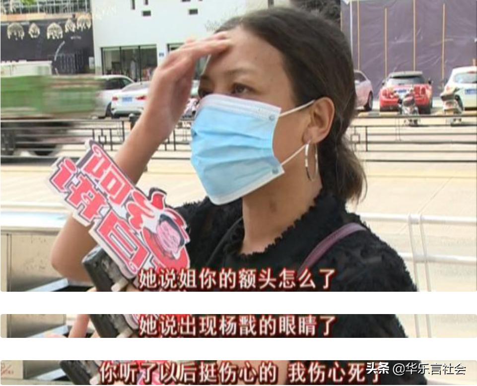 女子整容脂肪填充瘫痪,女子整容额头