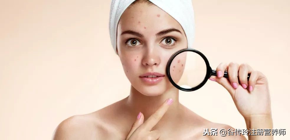 长痘忌口的食物有哪些,长痘忌口的食物一览表