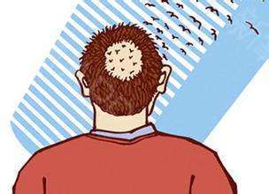 治疗脱发不脱发的办法,一招解决你的脱发秃顶