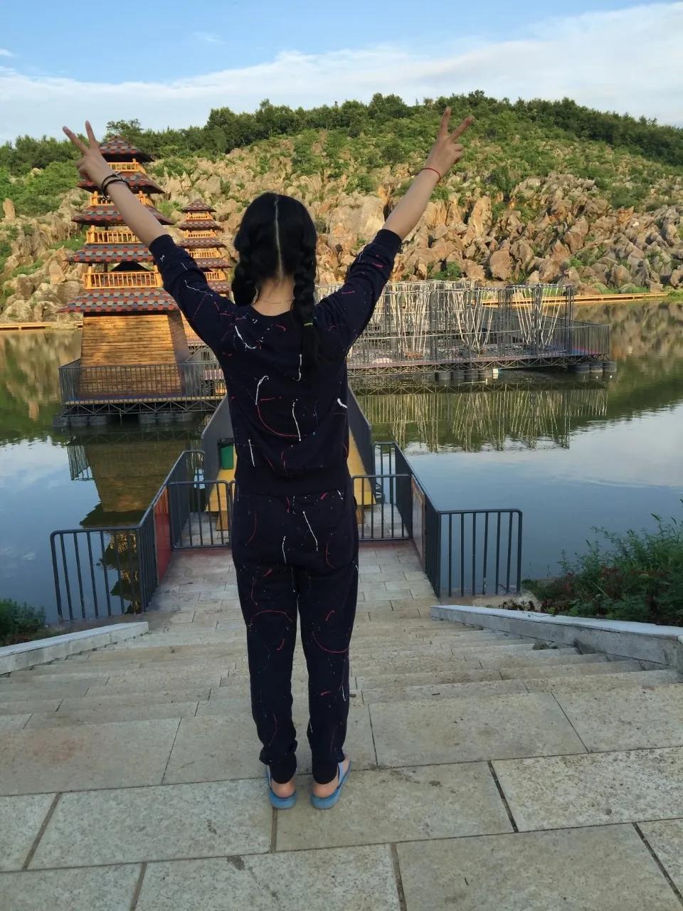 狼疮治疗记录,狼疮肾炎10年了