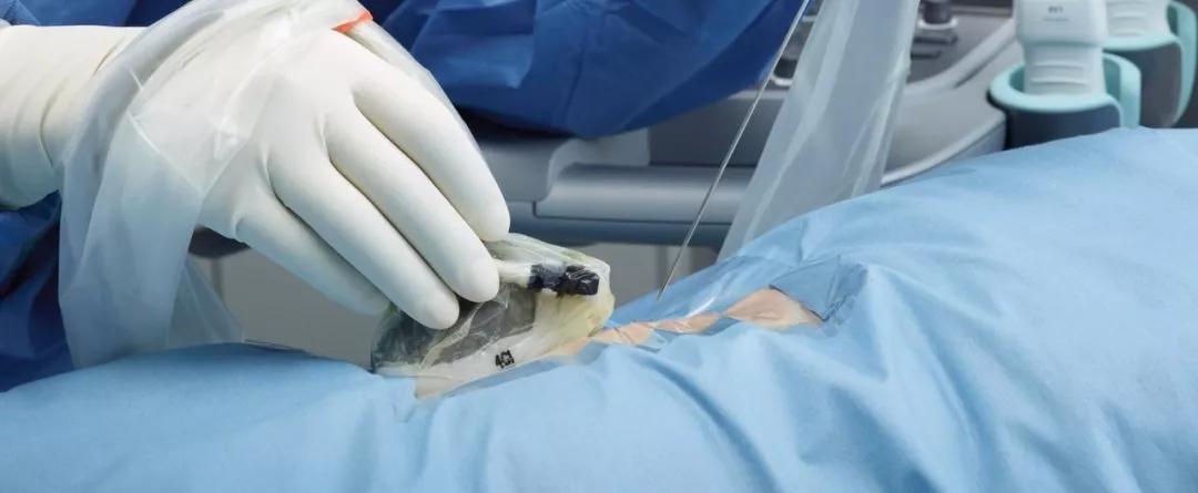 体检查出肺结节莫慌中医有妙招,体检查出肺结节别慌