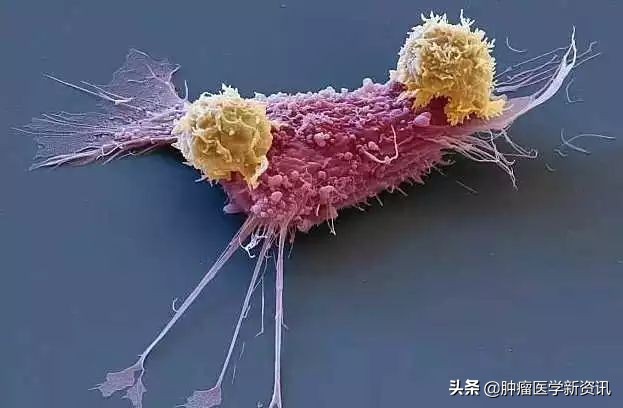 21年里患癌5次他被医生赞为传奇,三度患癌却依然成功抗癌30年