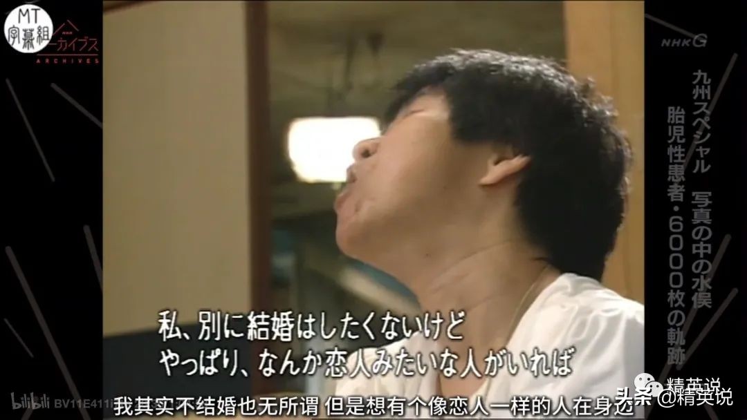 60多年前日本万人中毒成世界公害！如今福岛百万吨核废水入海…