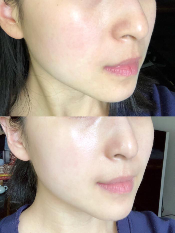 薏仁水娥佩兰测评好用吗,薏仁水爽肤水测评