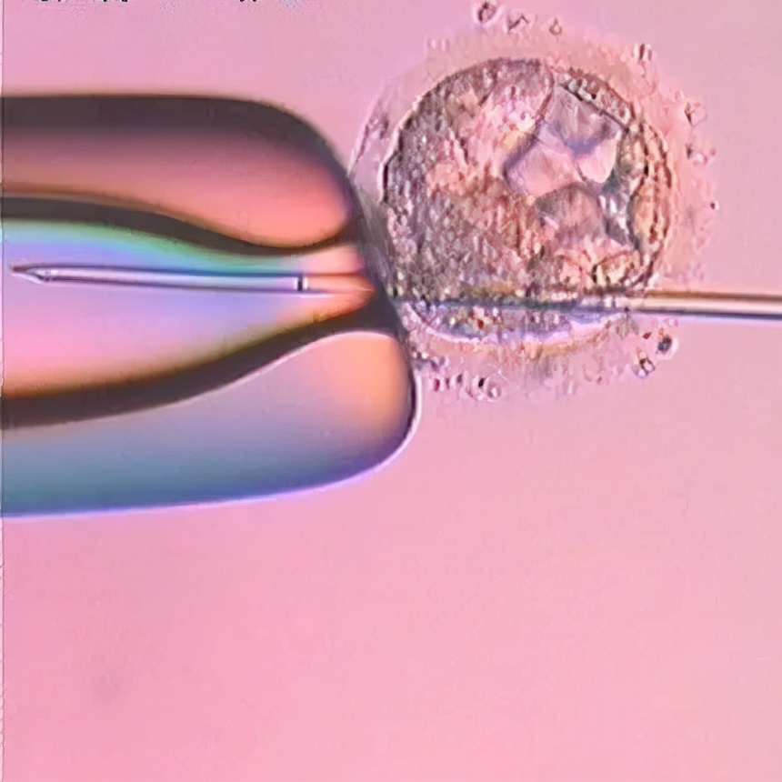 中医喊你来治疗慢性盆腔炎，多的是你不知道的优势