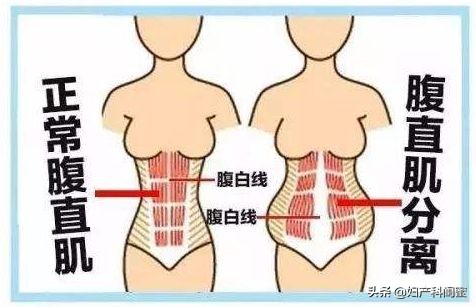 产后能恢复到少女时期的紧致,产后怎么快速恢复到少女身材