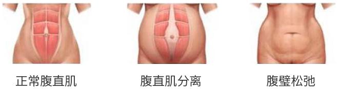 这篇塑身衣文章，我准备了半年