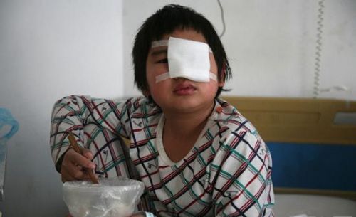 儿童丧失视力，或许是视网膜母细胞瘤在作祟，治疗方法有哪些？