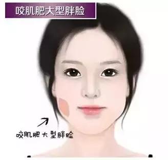 解密瘦脸针的几大常识性问题,关于瘦脸针的真实事件