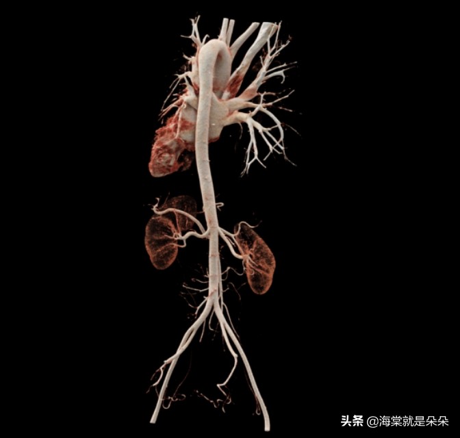 先天漏斗胸跟心脏不好有关吗,成年人漏斗胸压迫心脏