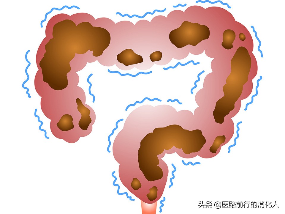 老年人便秘的有效治疗方法,解决老年人便秘最有效的方法