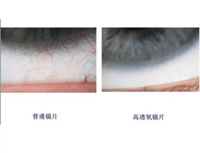 适合新手小白佩戴的隐形眼镜,隐形眼镜三无产品