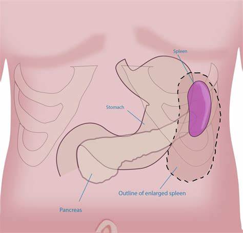 体检说脾增大什么意思,体检报告说肝硬化可能性比较大