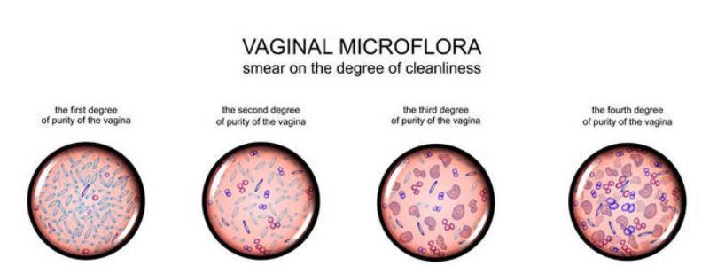 临床医生来不及和你解释的5大Y道炎误区,都在这里了