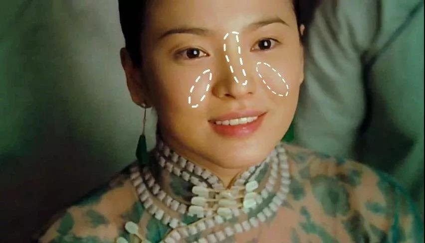 不通过医美法令纹泪沟怎么改善,法令纹泪沟最有效的解决办法