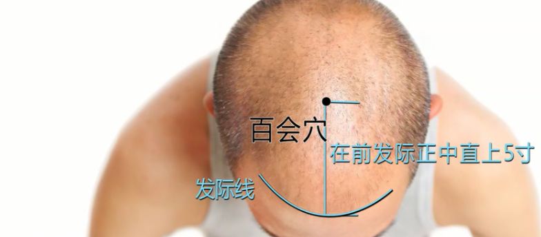 昏昏欲睡浑身乏力怎么缓解,每天睡不醒感觉很疲劳怎么办