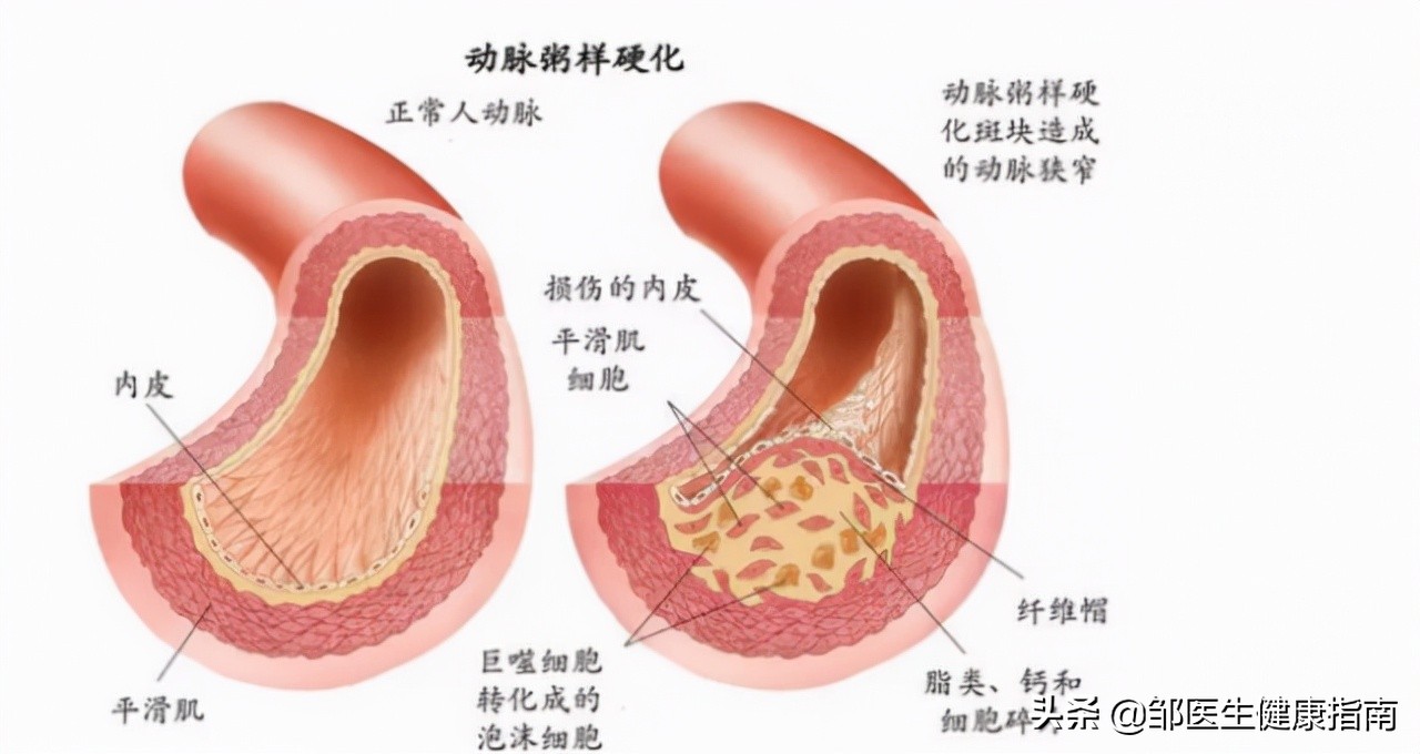 女人50岁是个什么坎,女人50岁下肢疼痛是什么原因