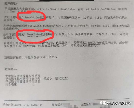甲状腺结节3类有药吃能治好吗,甲状腺结节3类喝中药能治好么