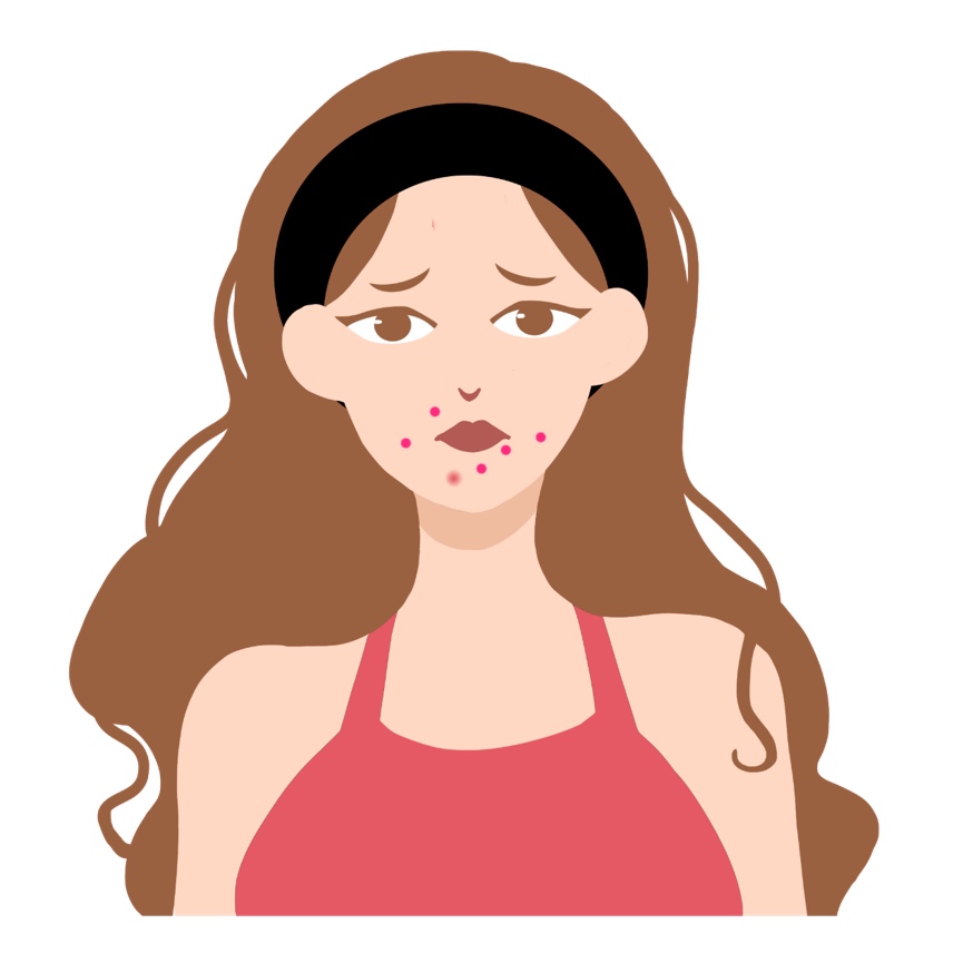 天天戴口罩闷痘用什么修复,上班天天戴口罩爆痘怎么办