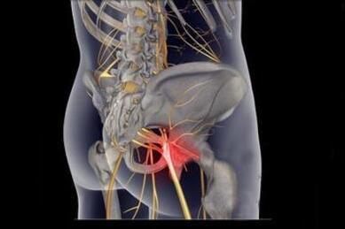 腰腿疼痛怎么引起的,腰腿痛最好的治疗方法是什么