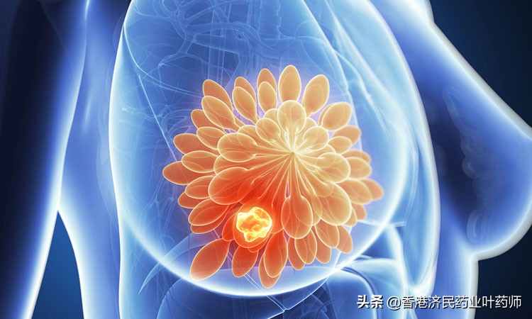 三阴性乳腺癌brca突变抑制剂,三阴性乳腺癌新药trop2