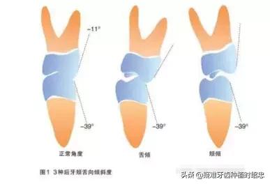 你的牙齿是否符合以上标准呢,你的牙齿够整齐吗