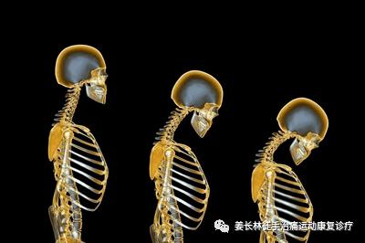 日常生活中的疼痛1—手麻（长时间玩手机）的判断和自我纠正