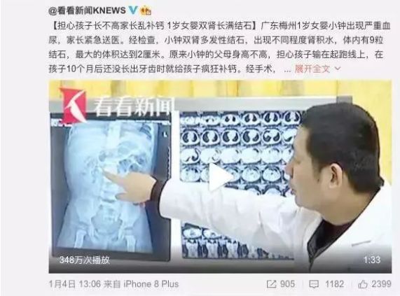 2岁男孩尿结石,2岁男童体内竟然有3颗肾结石