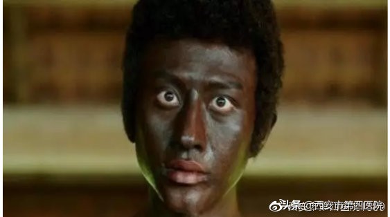 为什么感觉用防晒霜脸会变黑,出门涂防晒霜就真的不会变黑了吗